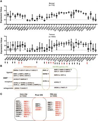 Aberrant expression of bone morphogenetic proteins in the disease progression and metastasis of breast cancer